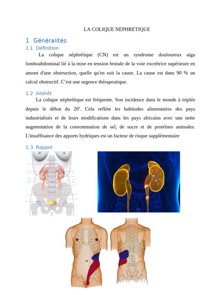 La Colique Néphrétique | PDF | Spécialités médicales | Maladies et troubles