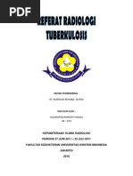 Download TUBERKULOSIS RADIOLOGI by Gleopatra Dorothy Molle SN102655364 doc pdf