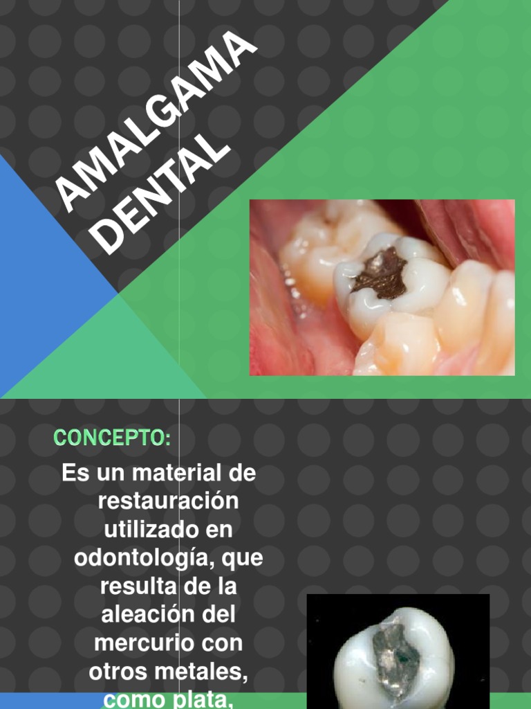 Amalgama Dental PDF Átomos Rieles