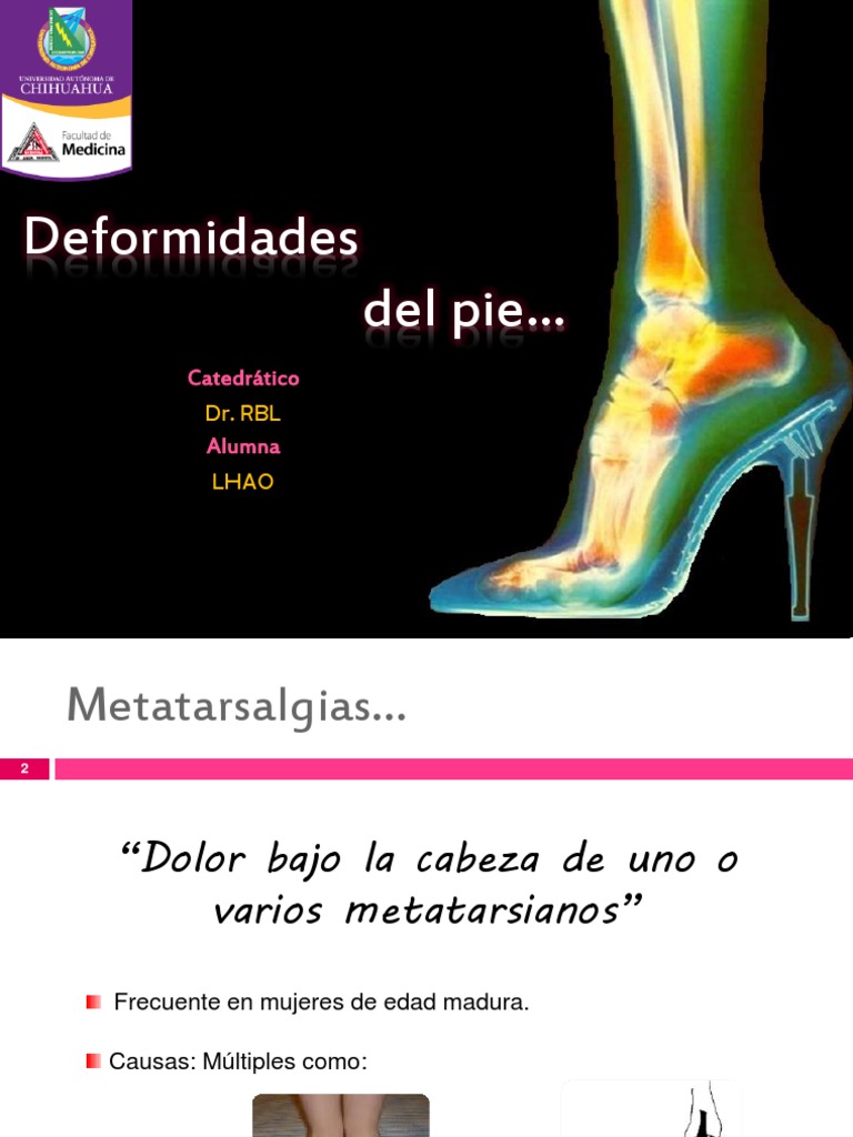 Presentación1 Dedo del pie Pie Prueba gratuita de 30