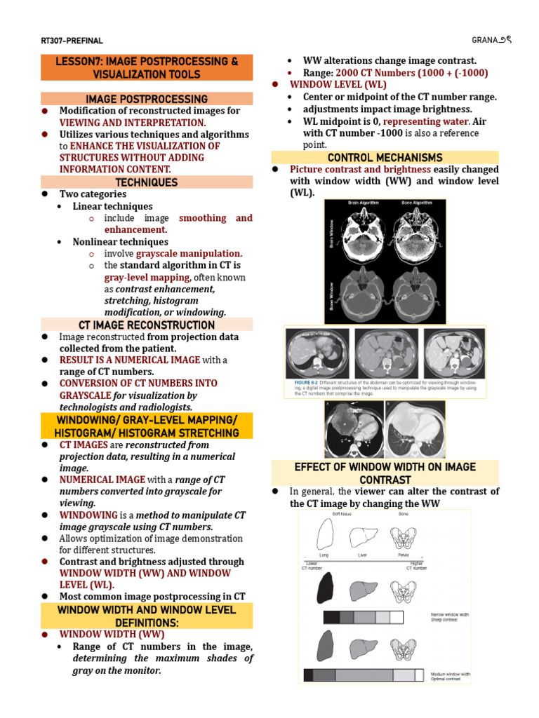 RT308 Prefinal | PDF | Ct Scan | Medical Imaging