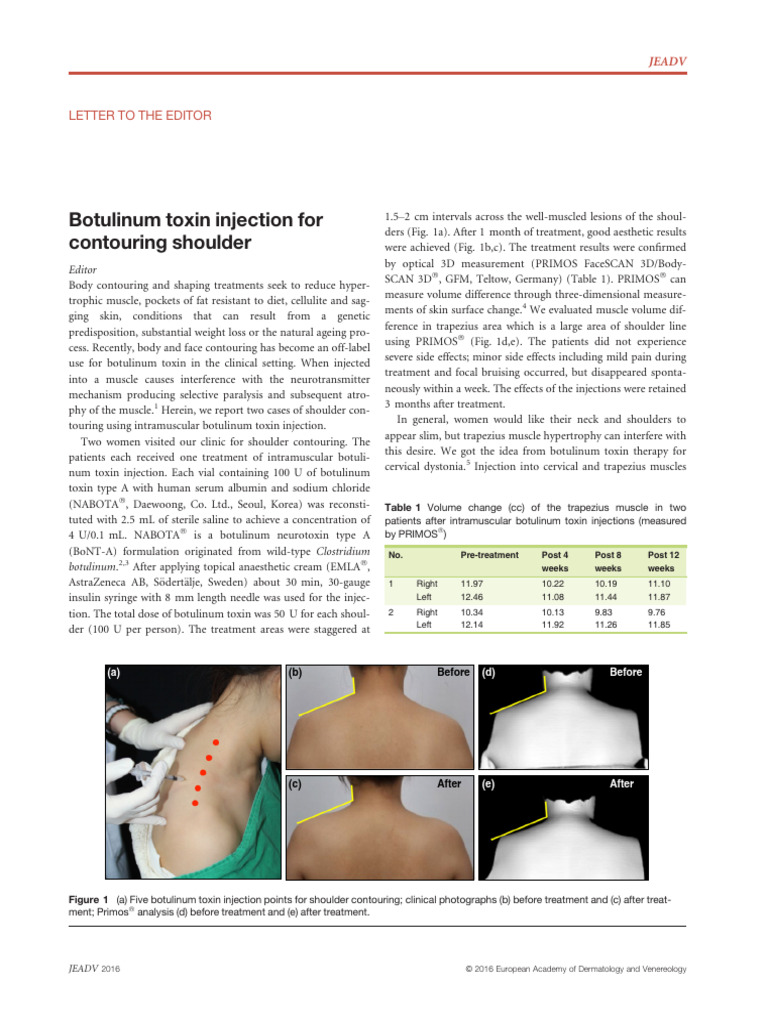 Botulinum Toxin Injection for Contouring Shoulder | PDF | Botulinum ...