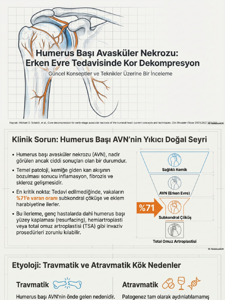 Humeral Head AVN Core Decompression Concepts | PDF