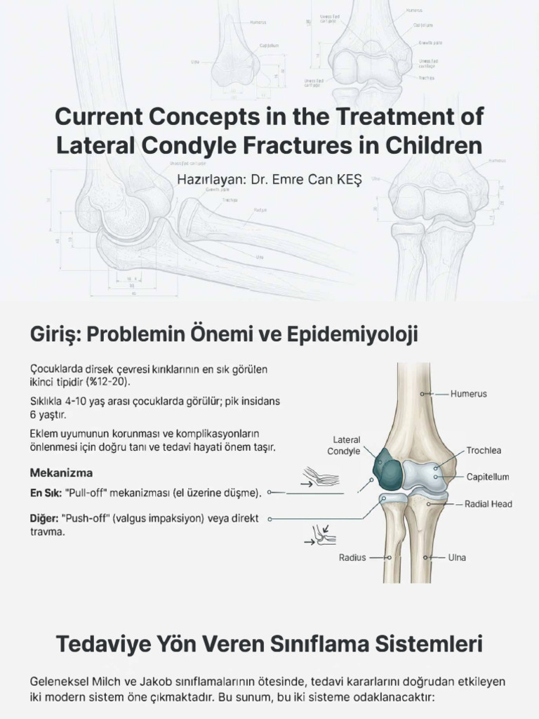 Lateral Condyle Fractures Management | PDF