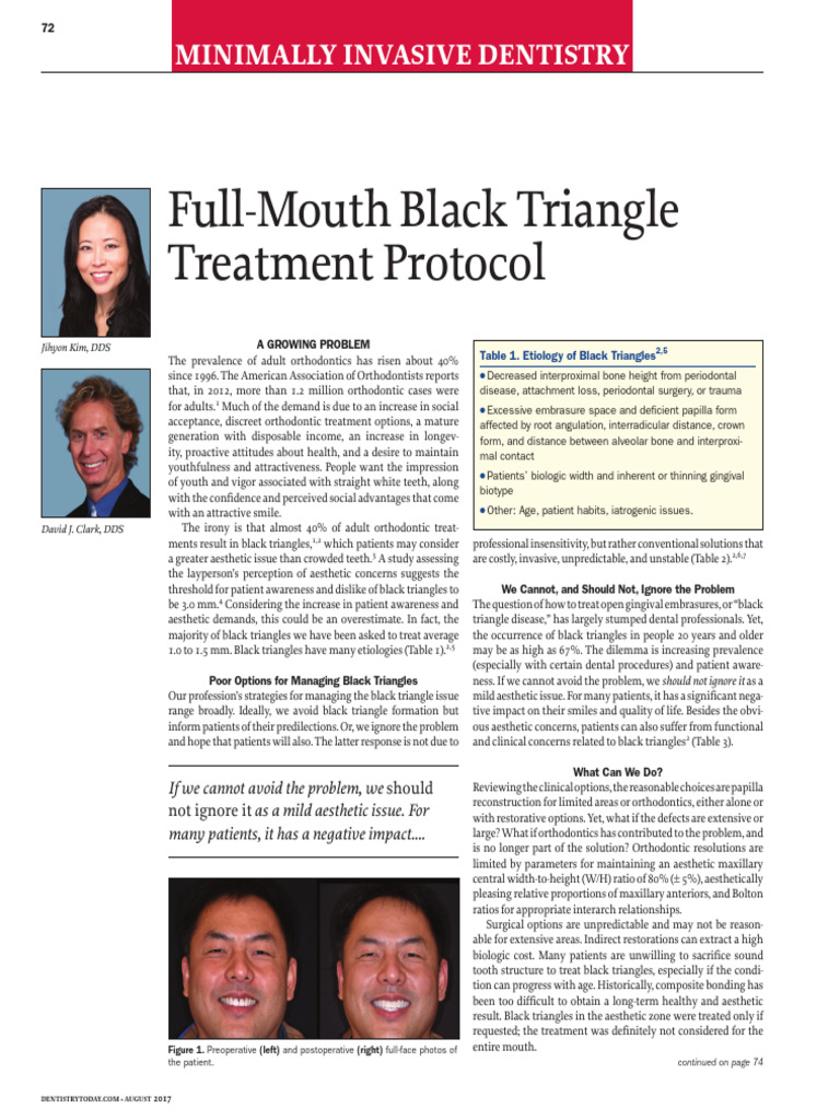Full Mouth Black Triangle Treatment Protocol | PDF | Orthodontics ...