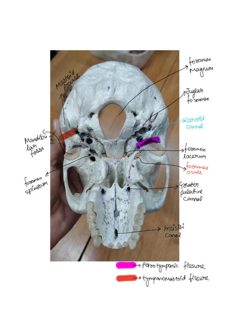 Neuro Cranium | PDF