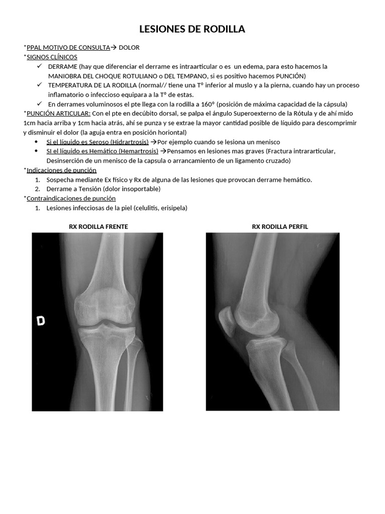 Lesiones de Rodilla | PDF | Rodilla | Extremidades (anatomía)