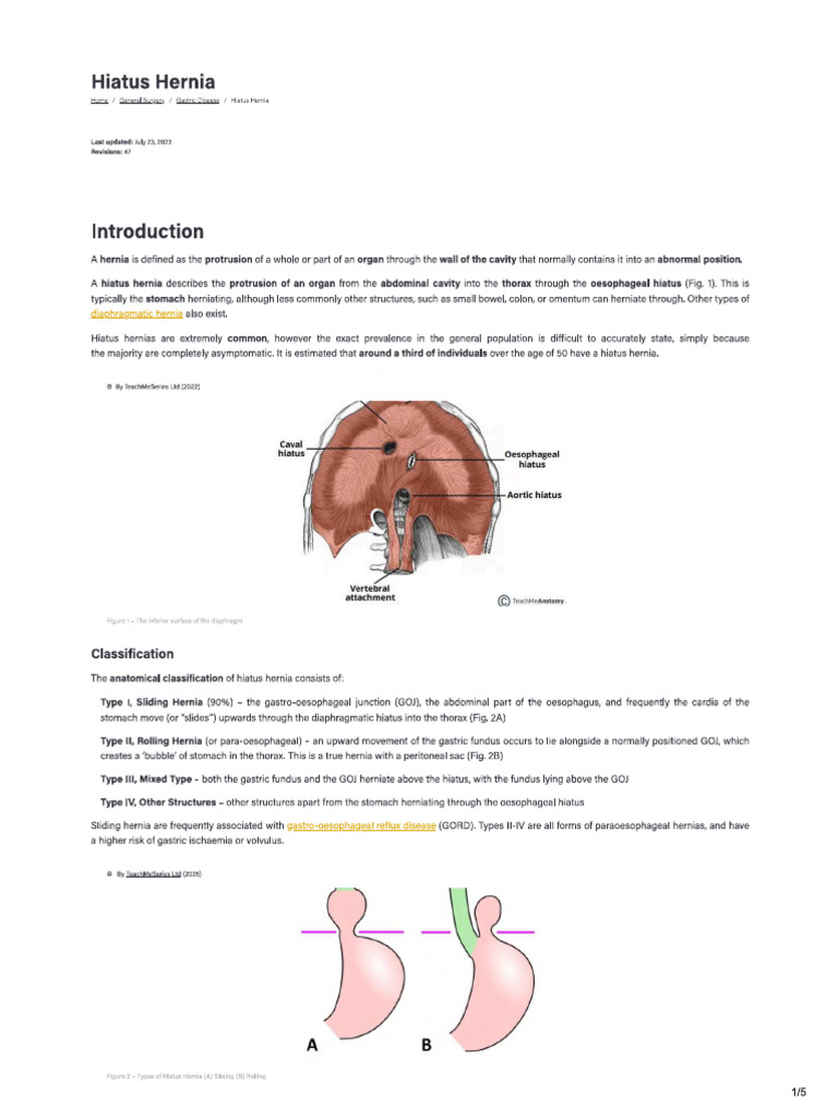 Hiatus Hernia | PDF