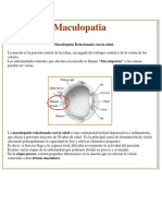 Maculopatia