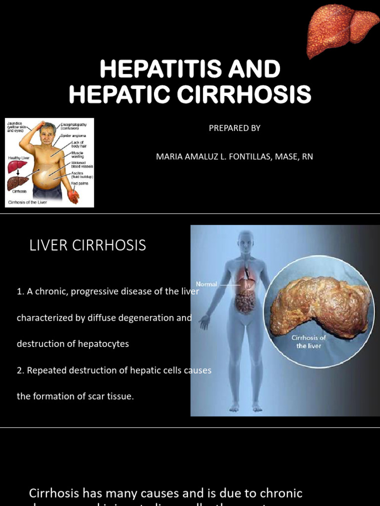 Liver Cirrhosis and Hepatitis | PDF | Liver | Cirrhosis