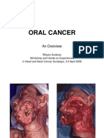 4 Overview Oral Cancer-WayanS,DrSpB