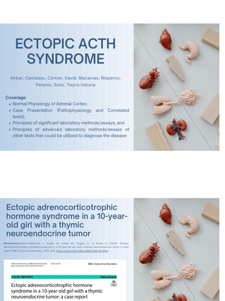 Ectopic ACTH Syndrome Case Study | PDF | Adrenal Gland | Cortisol