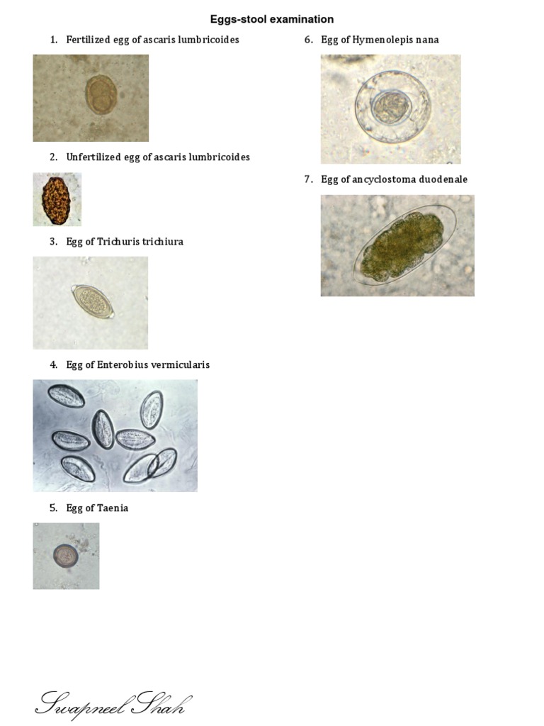 Eggs Stool Examination PDF