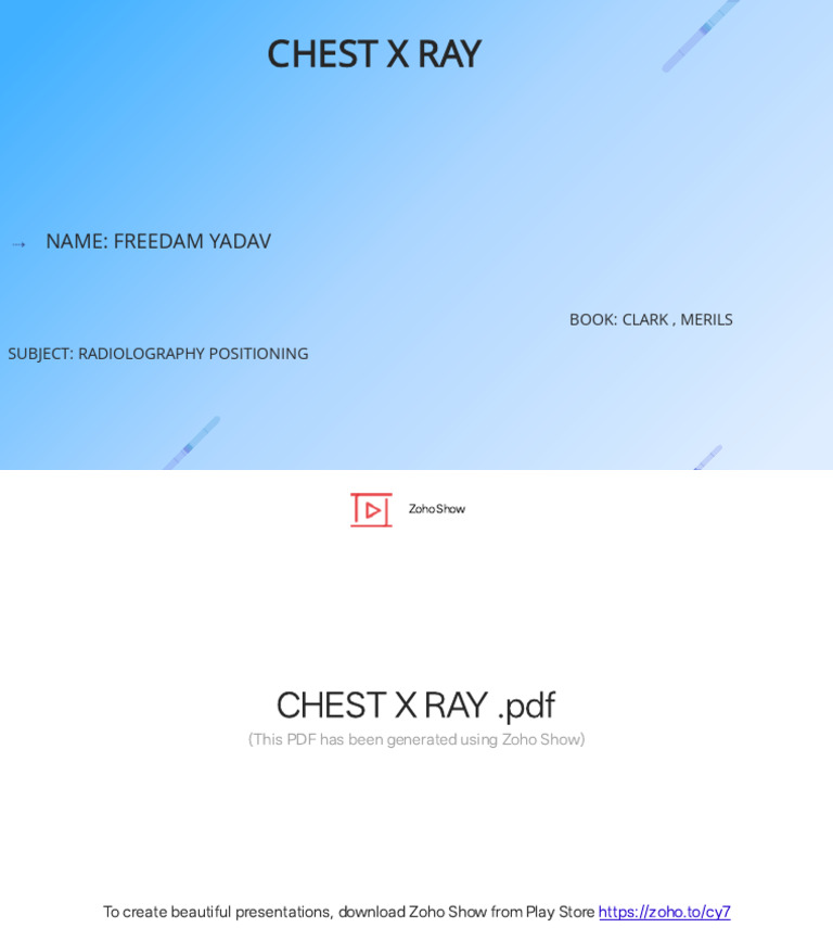 CHEST X RAY | PDF