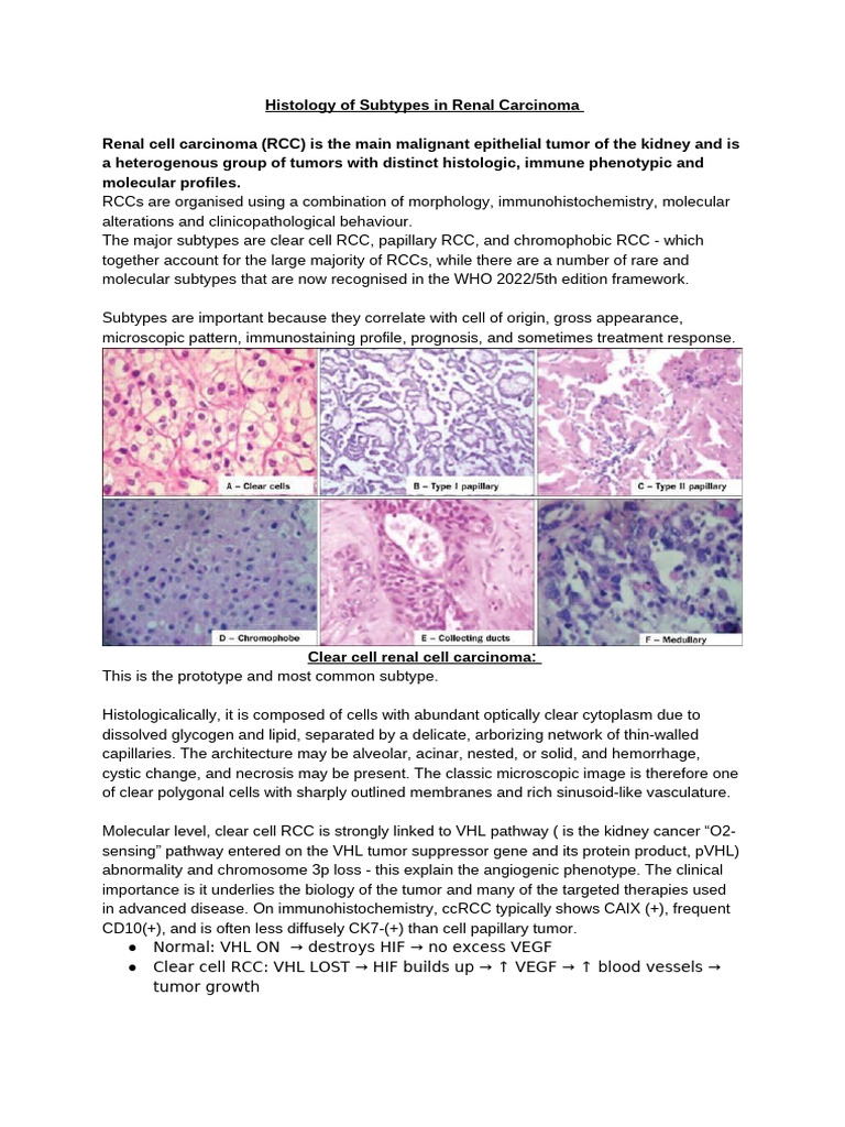 Histology of the Subtypes in Renal Carcinoma - Nandavaram Lahari | PDF ...