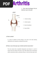 Arthritis