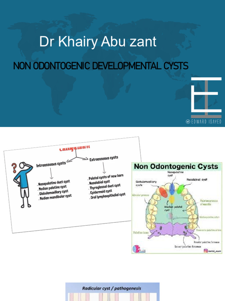 3…Non Odontogenic Developmental Cysts | PDF | Thyroid | Tongue