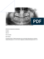 Mapeo Radiografico y Planeamiento Para La Colocacion de Un Implante