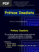 Prótese-Imediata-sem-fotos