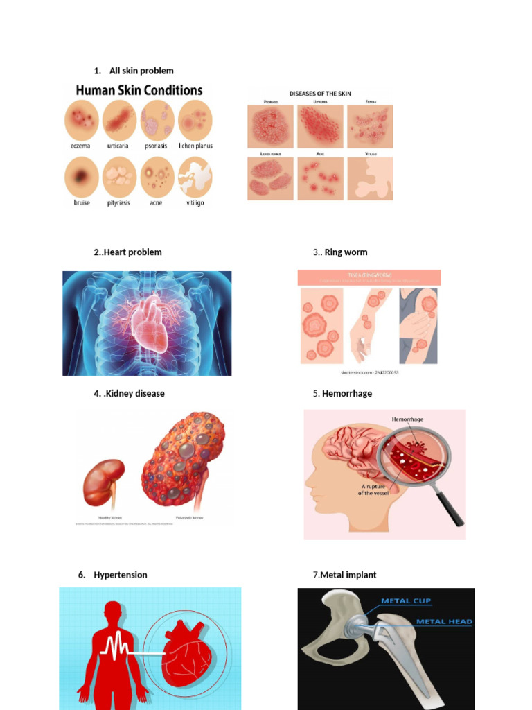 All Skin Problem | PDF