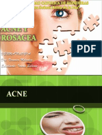 ACNE Y ROSACEA Presentación1