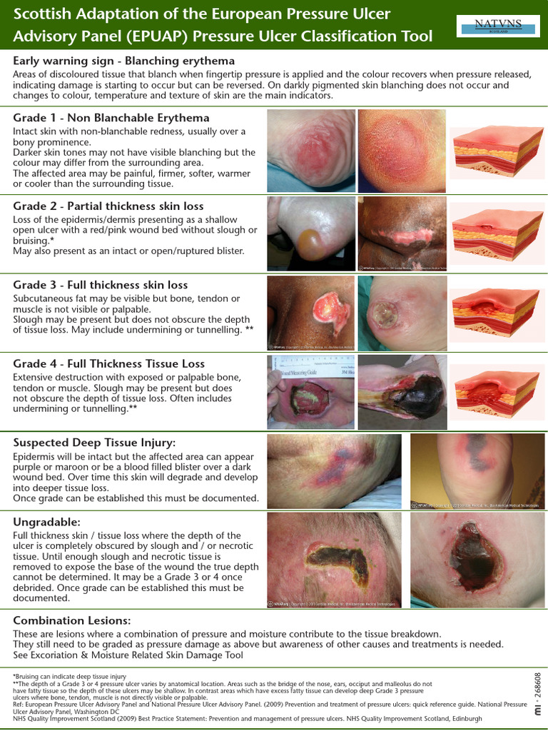 EPUAP Pressure Injury Grading-Tool | PDF | Skin | Dermatology