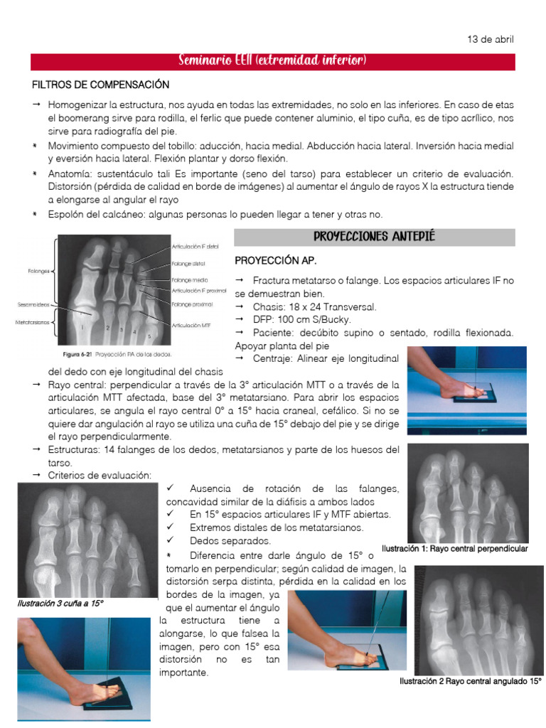 RB_ 7 Seminario EEII (1) 2 | PDF | Tobillo | Rodilla