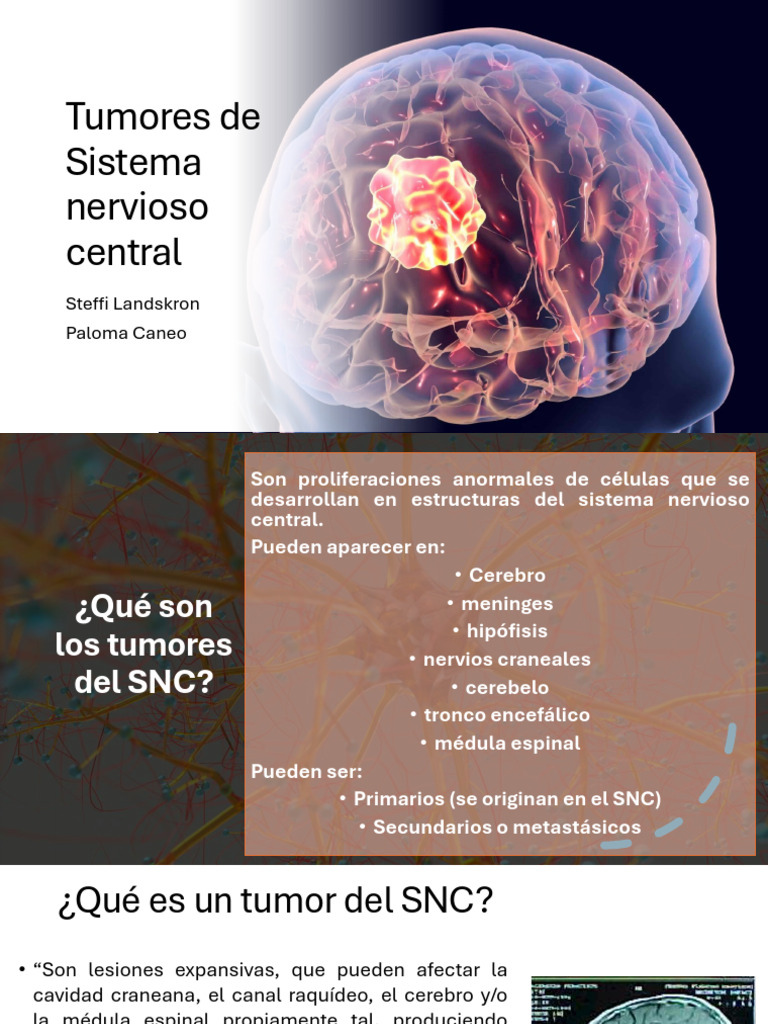 presentación TU SNC 2026 (1) | PDF | Sistema nervioso central | Cáncer