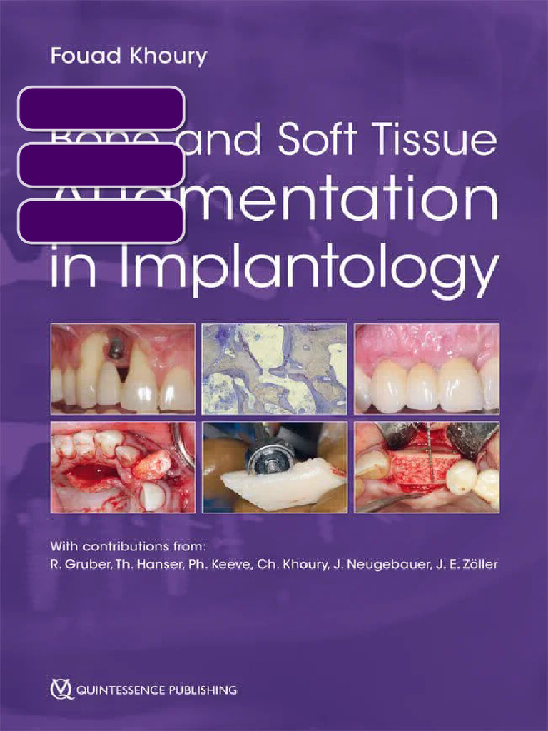 Bone and Soft Tissue Augmentation in Implantology 1st Edition Fouad ...
