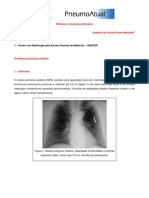 Rx tórax - Nódulos e massas