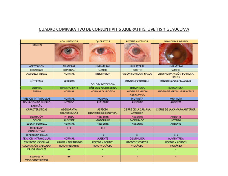 CONJUNTIVITIS | PDF | Glaucoma | Sistema visual