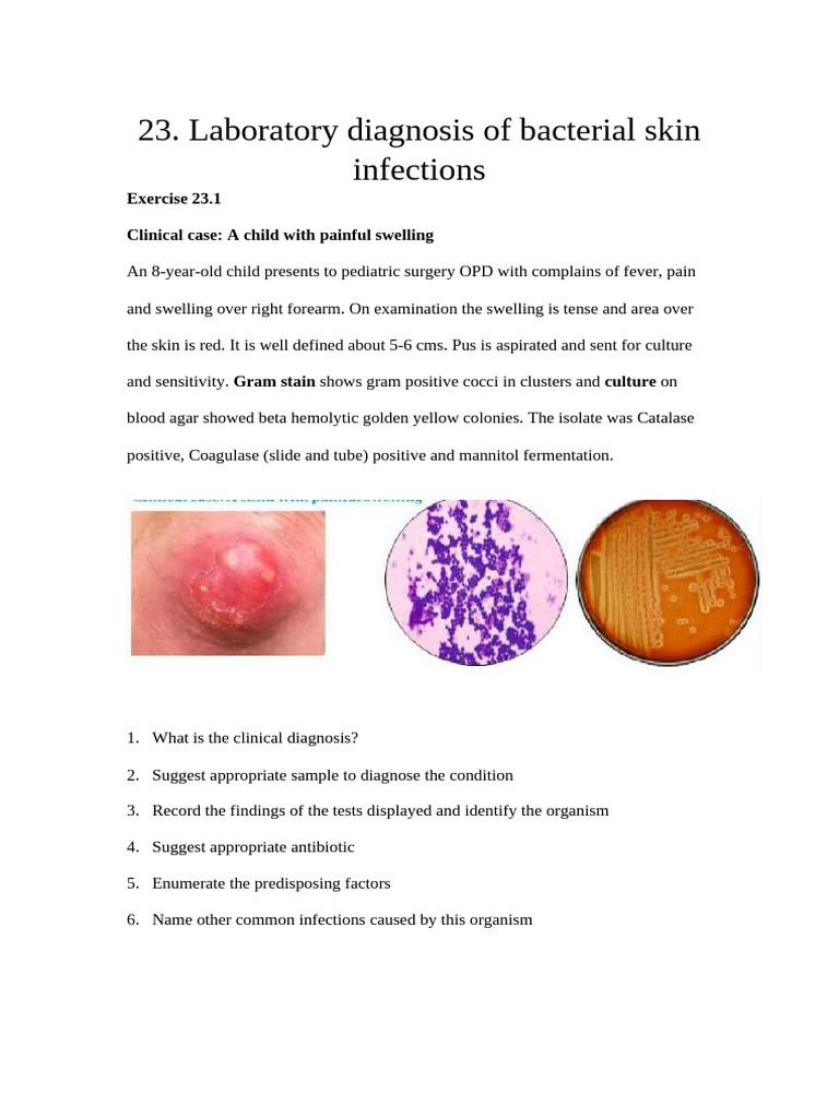 23. Bacterial Skin Infections- Abscess , Cellulitis | PDF ...