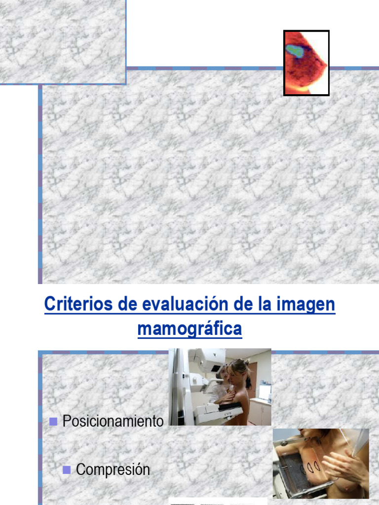 Mamografía 2 Principios | PDF | Mamografía | Rayo X