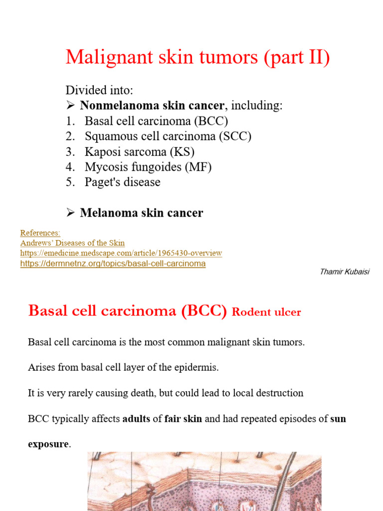 Malignant Skin Tumors Part II | PDF | Skin Cancer | Melanoma