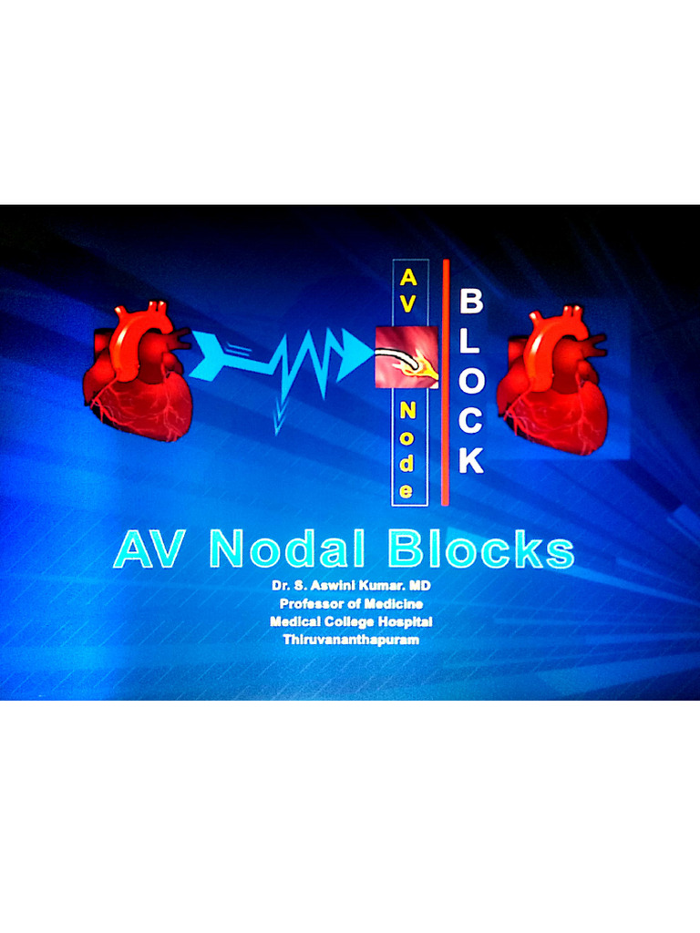 Heart Block | PDF