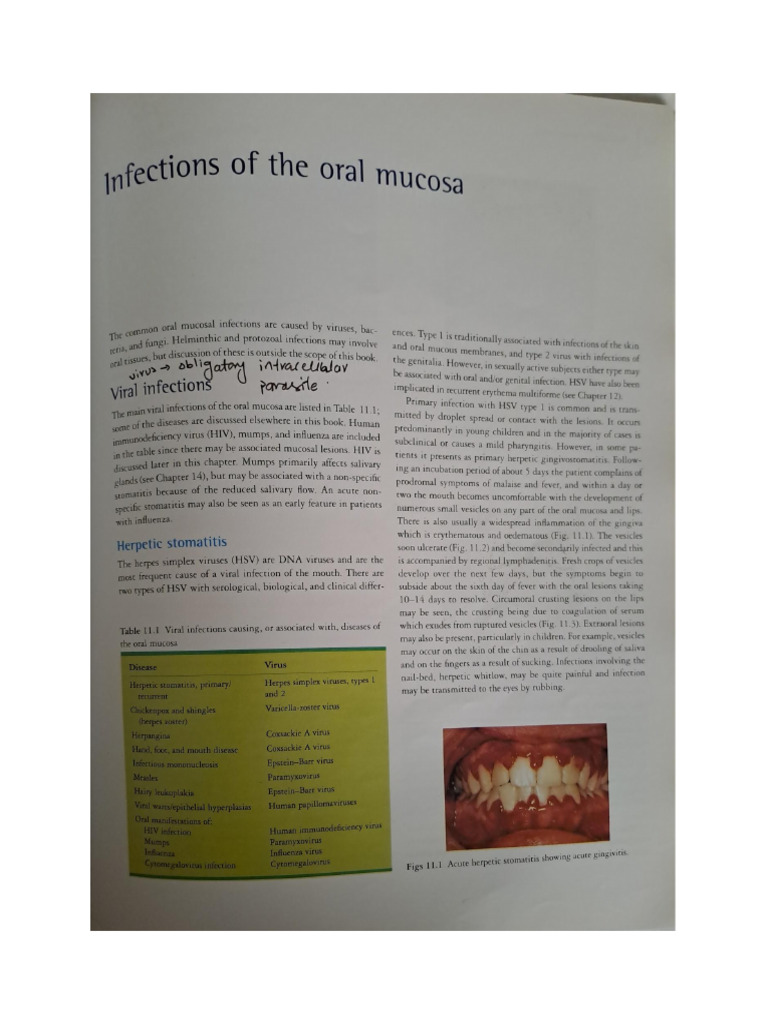 oral infections | PDF