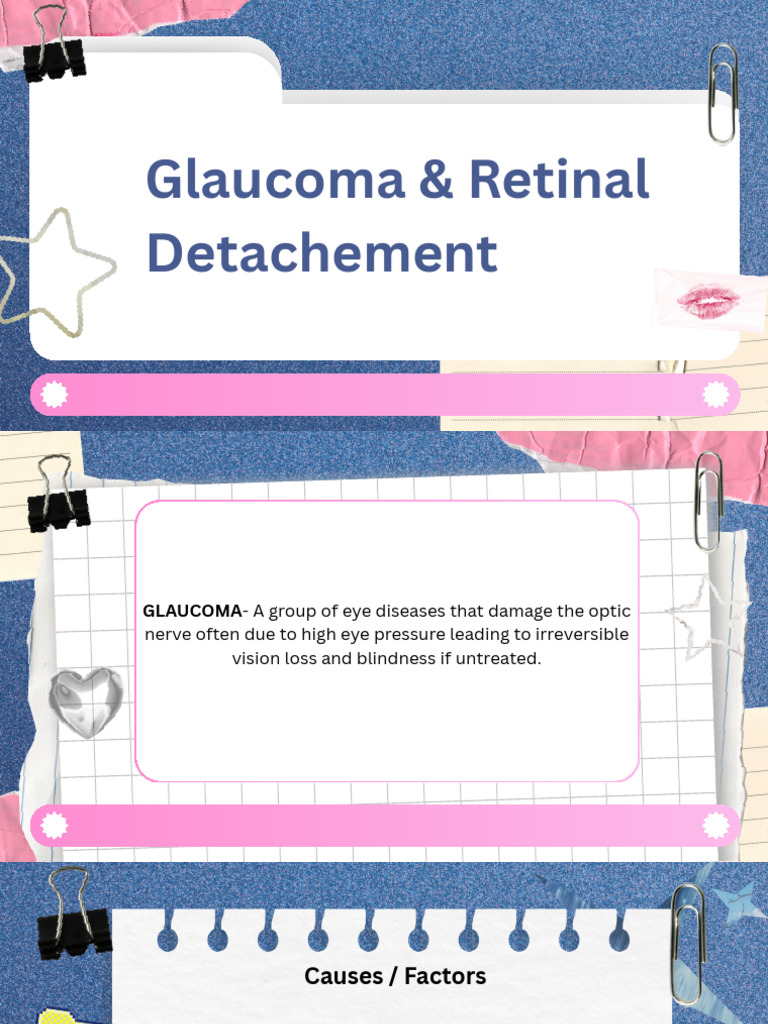 Glaucoma and Retinal Detachment | PDF | Glaucoma | Medical Specialties