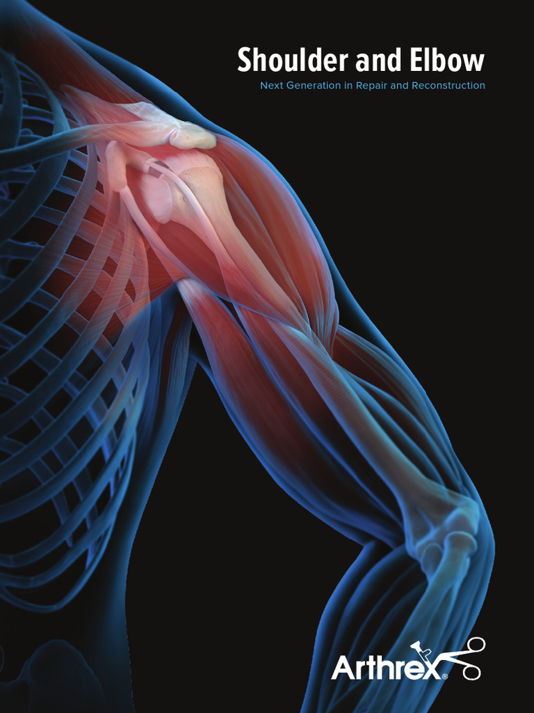 Shoulder and Elbow Next Generation in Repair and Reconstruction | PDF ...