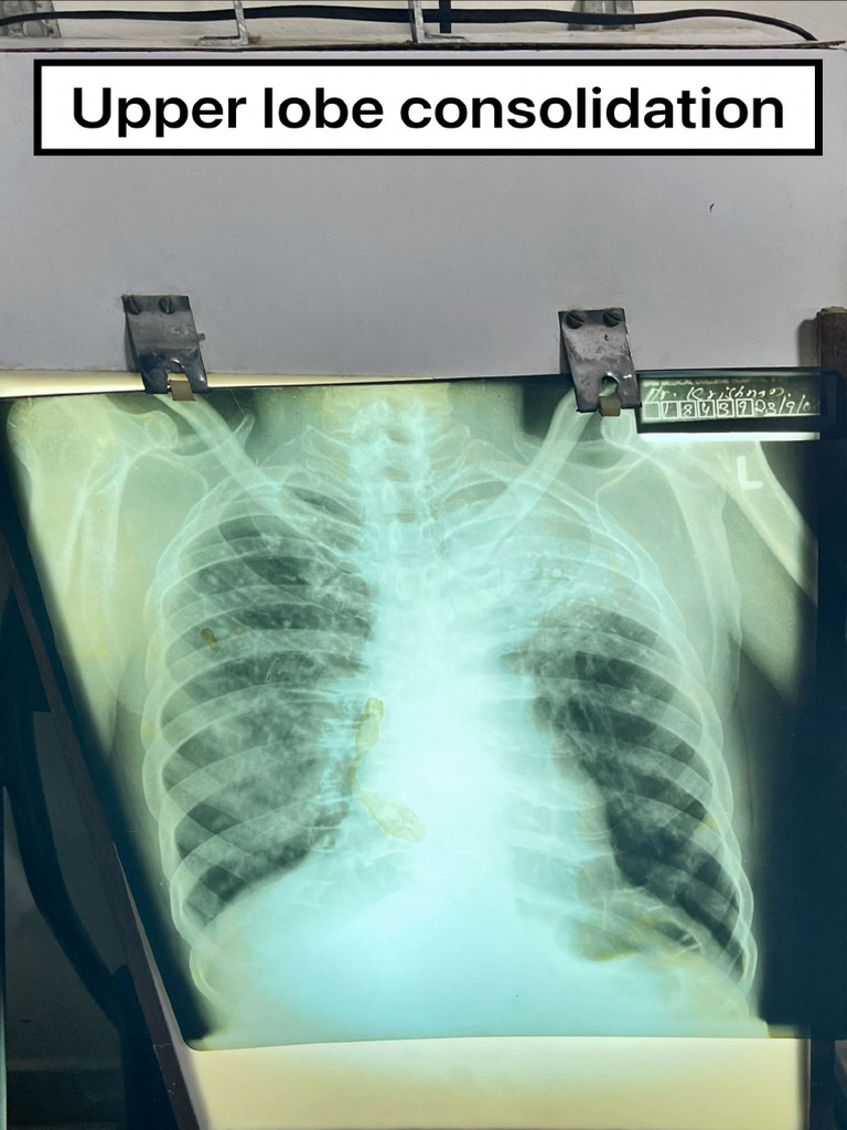 GM xrays | PDF