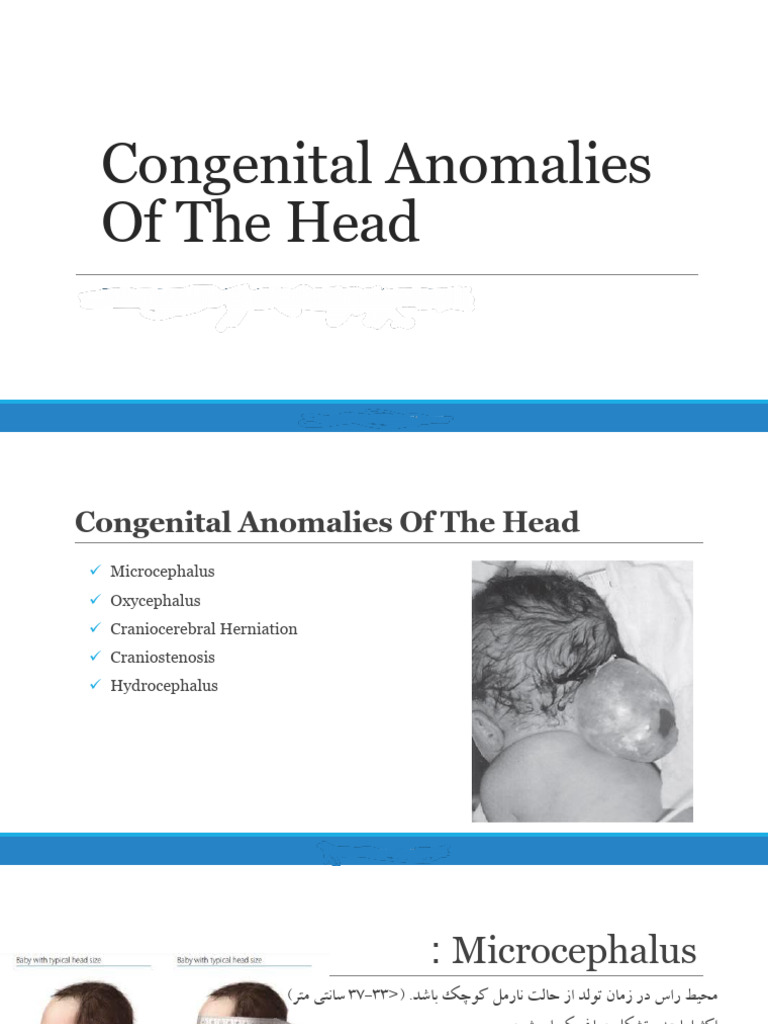 Congenital Anomalies | PDF