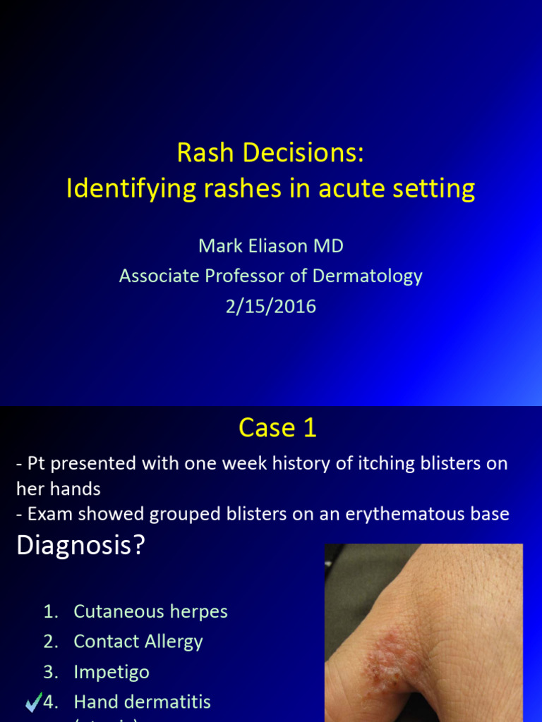 Rash_Decisions_Identifying_Rashes_and_Treating_in_Acute_Setting | PDF ...