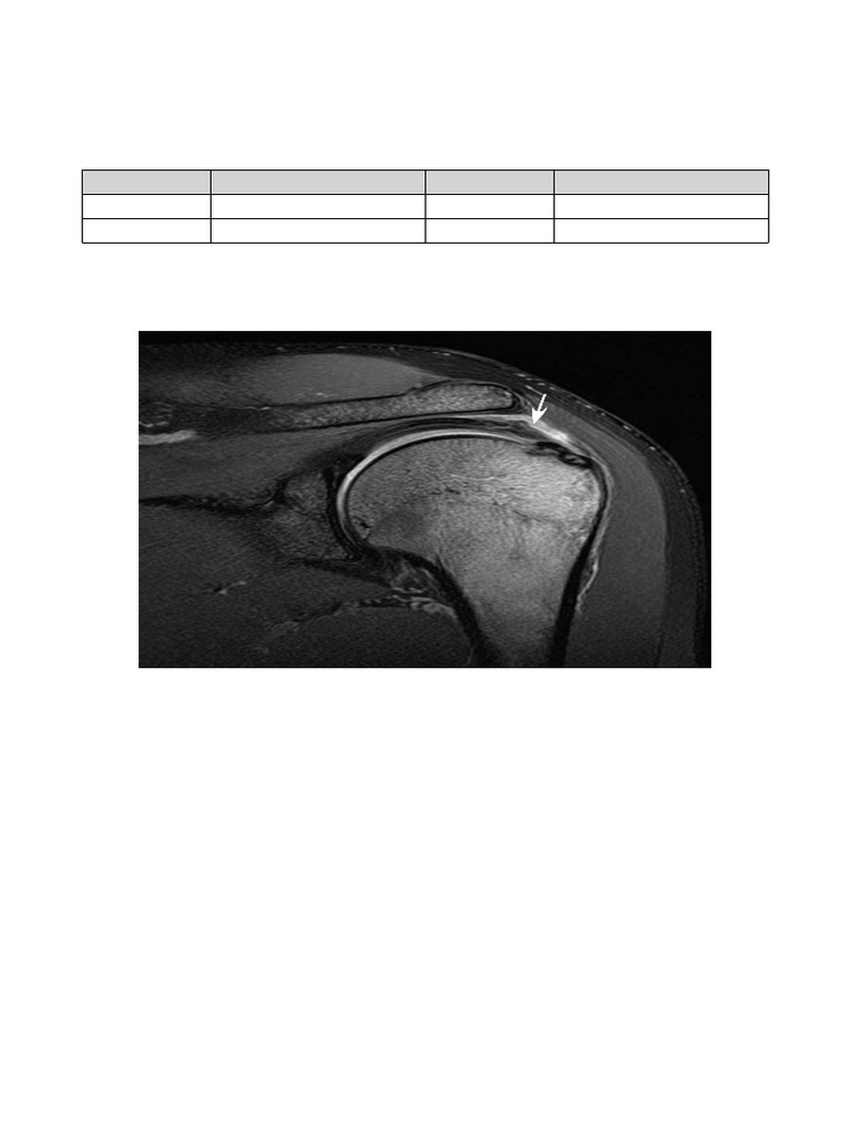 Realistic MRI Shoulder Report | PDF