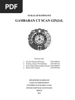 Download Gambaran CT-Scan Ginjal by Erwin Siregar SN103714386 doc pdf