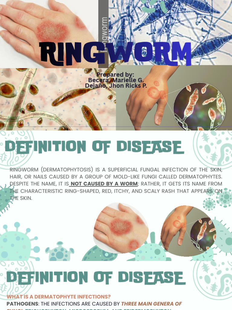 RINGWORM | PDF | Medical Specialties | Dermatology