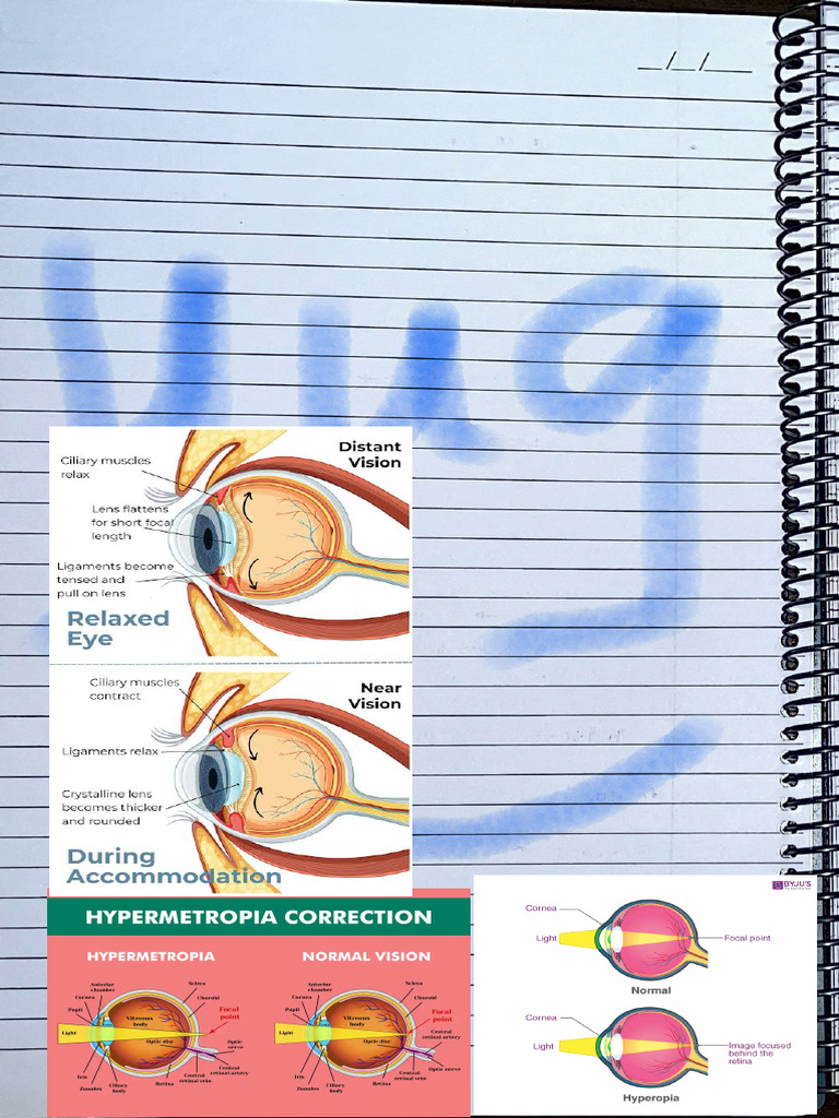 Yugant Gahane Ophthalmology Notes.pdf (1) | PDF