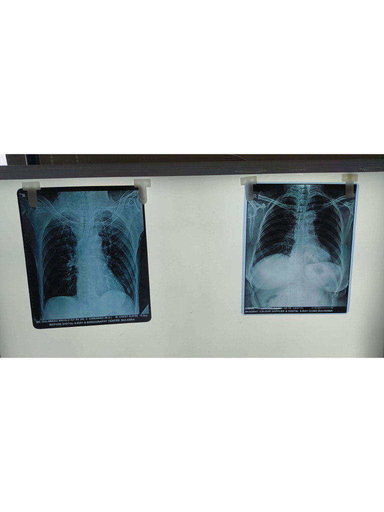 All X-ray | PDF