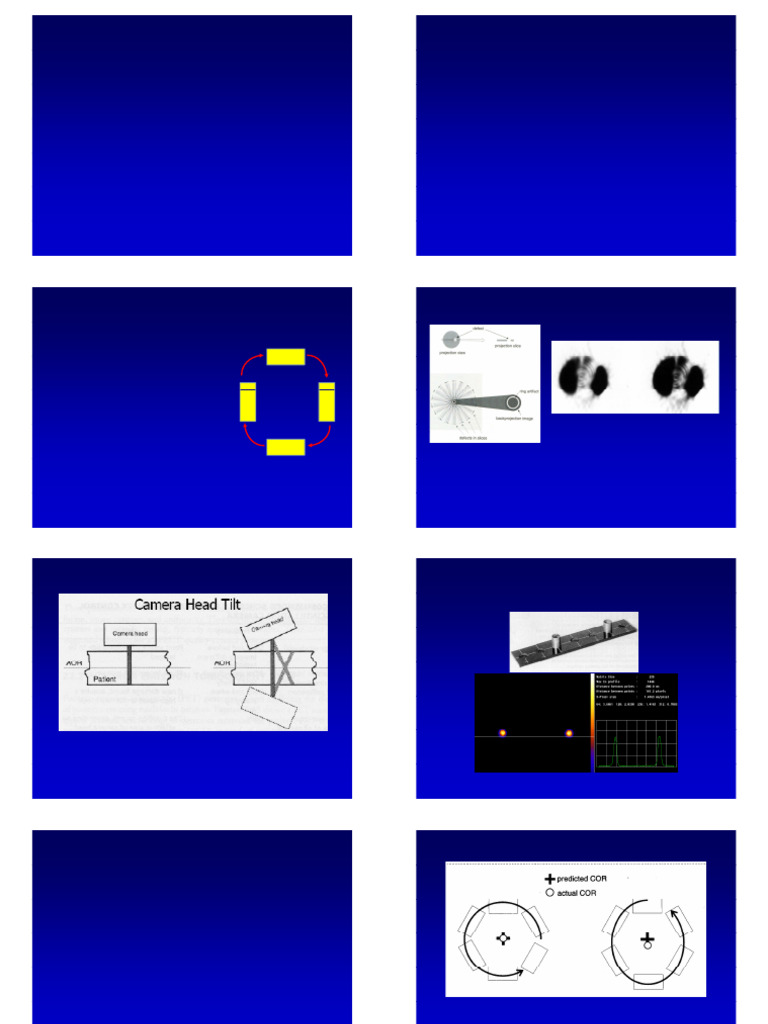 LECTURE 14 1pp Gamma Camera SPECT Quality Control | PDF | Vision ...