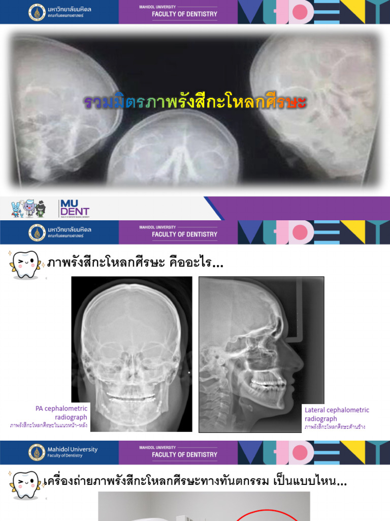 New Cephalometric Radiography for Print | PDF