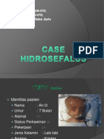 Hidrosefalus