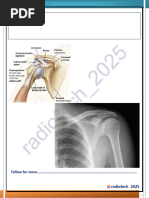 Grashey Method for Shoulder Imaging | PDF | Shoulder | Musculoskeletal ...